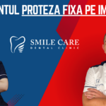 Tratament Proteză fixă pe implanturi la Smile Care